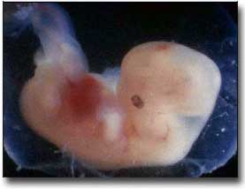 5 bis 6 Wochen alter Embryo